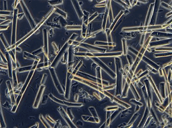 Image: Silk fibers reinforcing the biodegradable scaffold material (Photo courtesy of Tufts University). Image: Silk fibers reinforcing the biodegradable scaffold material (Photo courtesy of Tufts University).